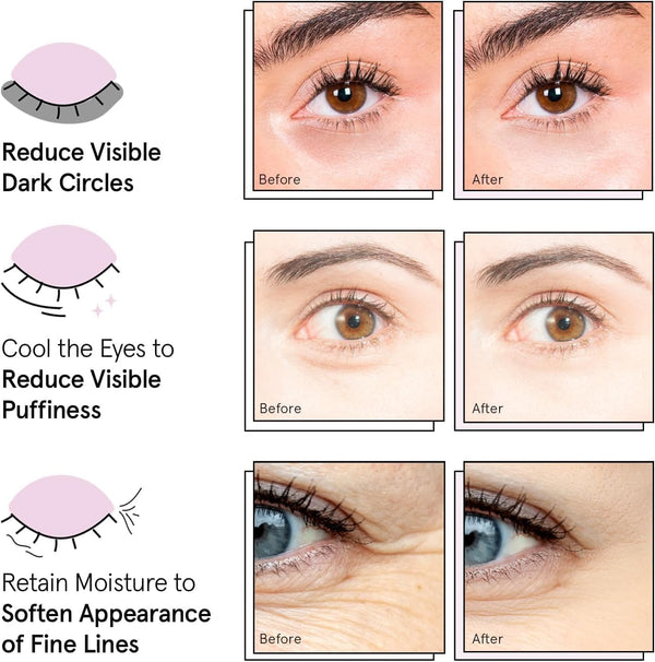 Gold Glow Eye Masks